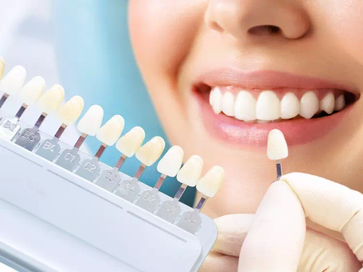 dobieranie koloru zębów